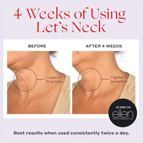 Vista 4 de Womaness Suero Reafirmante de Cuello - Hidrata, Levanta y Suaviza con Aplicador de Rodillo Enfriante y Masajeador - Crema para Mujeres para Suavizar