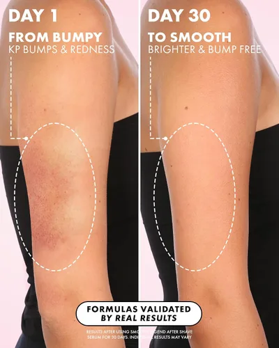 Vista 8 de Truly Suero para después del afeitado Beauty Smooth Legend Reduce