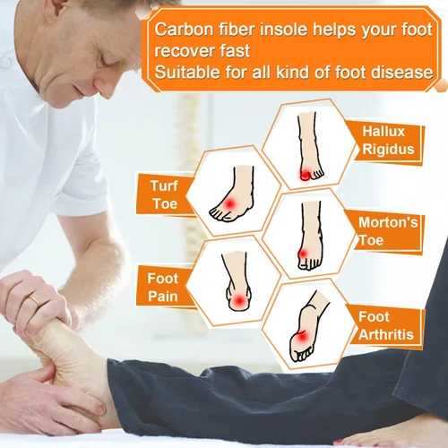 Vista 2 de Plantillas de fibra de carbono, 1 par de plantillas rígidas para aliviar el dolor, recuperación de la puntera de césped artrítico, Hallux rigidus