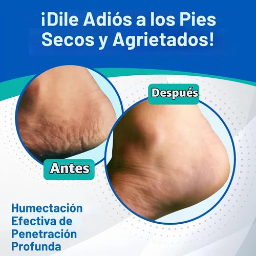 Vista 5 de Crema para talones Dermal Therapy, 3 onzas