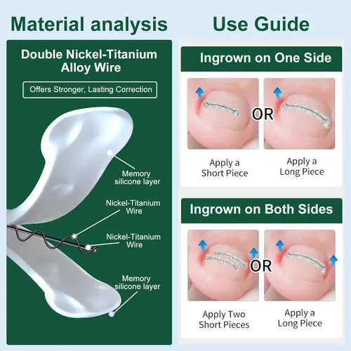 Vista 6 de Corrector de uñas encarnadas de nitinol dual, tratamiento de uñas encarnadas, enderezador de uñas curvas, kit de eliminación de uñas encarnadas