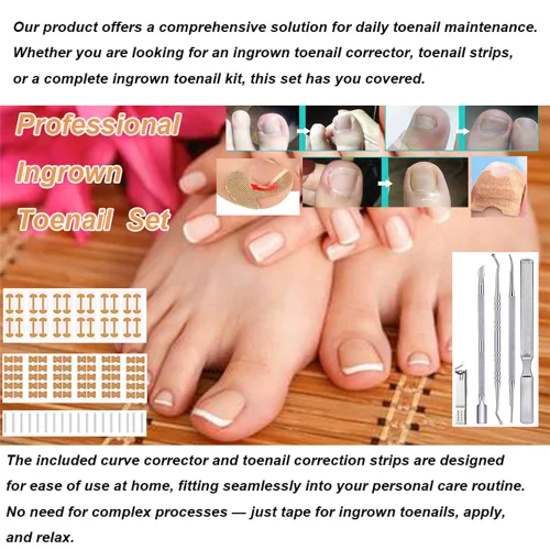 Vista 2 de Tratamiento de uñas encarnadas, juego profesional de herramientas de pedicura de uñas encarnadas, 60 piezas de parche corrector de uñas