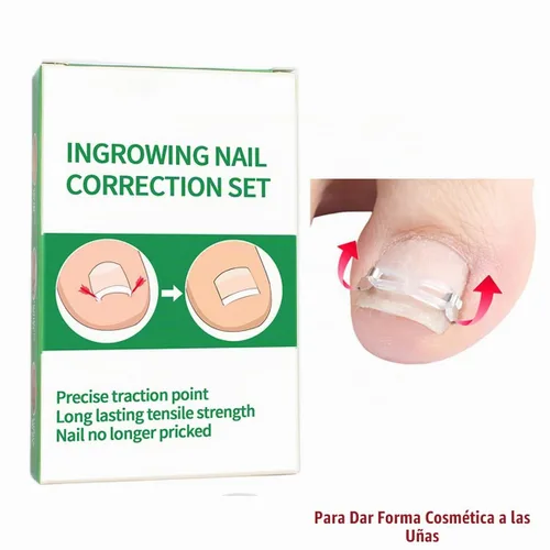 Vista 6 de Kit de corrección de uñas encarnadas Professional Nail Care Tools, Correction Clips and Adhesive Pads, Four Correction Clips, Correct Two Toenails