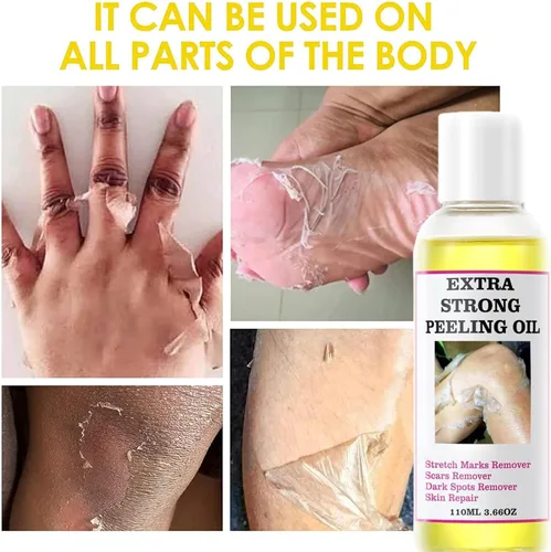 Vista 2 de Aceite de pelado amarillo, aceite de pelado fuerte para piel oscura, extra fuerte, solución exfoliante para el cuerpo, todo tipo de piel, removedor
