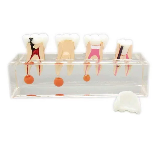 Vista 3 de Modelo de tratamiento endodóntico de 4 etapas para estudiar los dientes de enseñanza Modelo #4003
