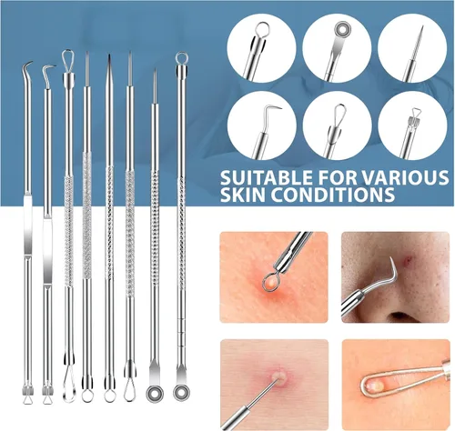 Vista 5 de Kit de herramientas para eliminar puntos negros, herramienta extractora de espinillas, herramienta extractora de espinillas, herramienta profesional