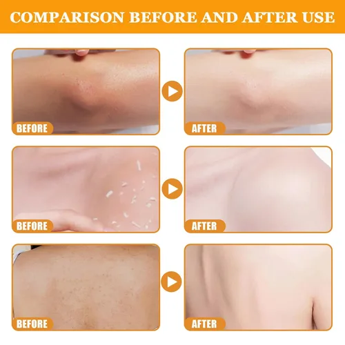 Vista 6 de Gel exfoliante naranja para cara y cuerpo, gel de pelado naranja, piel hidratante profunda y suciedad de poros de limpieza (2 unidades)