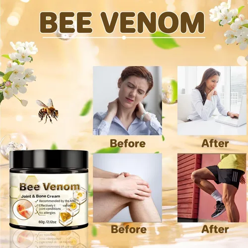 Vista 2 de ArthroEase - Crema de veneno de abeja para la artritis, crema calmante de veneno de abeja para articulaciones y músculos, crema profesional