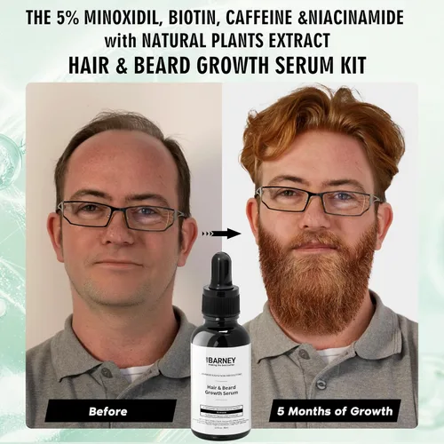 Vista 3 de Suero para el crecimiento del cabello y la barba de minoxidil al 5 %, extractos naturales, biotina y cafeína, promueve un crecimiento más fuerte