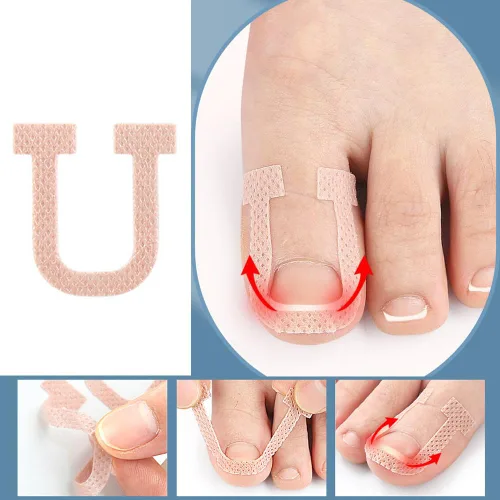 Vista 3 de Paquete de 40 parches correctores de uñas encarnadas en forma de U, correctoras de uñas de los pies, parches de corrección, vendajes para alivio
