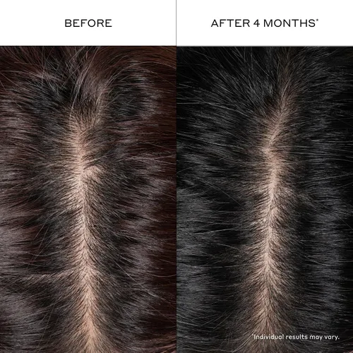 Vista 7 de Zenagen Suero engrosante para el cabello