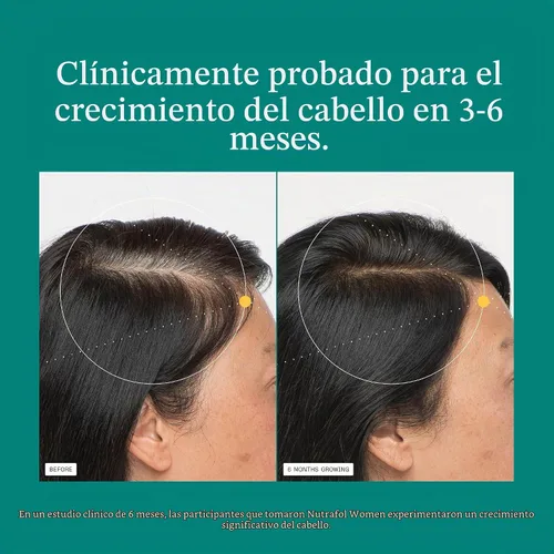 Vista 6 de Nutrafol Women Hair Growth Supplements, Ages 18-44, 1-Month Bottle