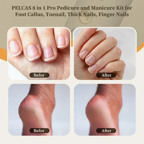 Vista 2 de PELCAS Taladro de uñas inalámbrico 8 en 1, lima de uñas eléctrico de 5 velocidades, kit de manicura y pedicura con luz LED, removedor eléctrico