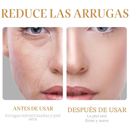 Vista 3 de Set de Cuidado de la Piel con Colágeno, 6 Piezas Sets de Cuidado Facial Antienvejecimiento para Mujeres, Reafirma la Piel, Reduce los Poros, Suaviza