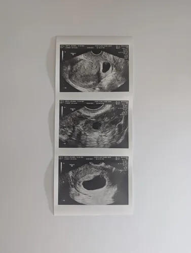 Vista 2 de Broma 2D personalizada tira de ultrasonido falso de 3 fotos