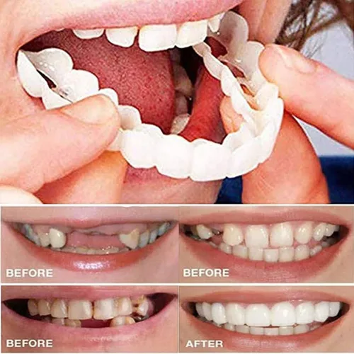 Vista 4 de womcare Kits de reparación de dientes falsos para llenar los dientes rotos y huecos que faltan - Kits de reemplazo de dientes falsos moldeables
