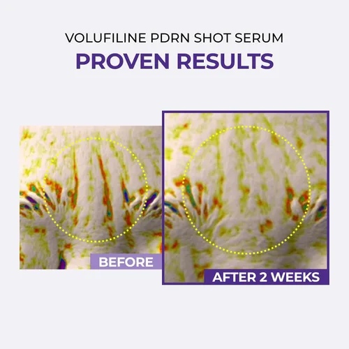Vista 2 de DOMINAS AtClinic Volufiline PDRN Serum - 2 semanas de volumen y elasticidad potenciador con 5% de volufilina, PDRN y paeonol, pérdida de volumen