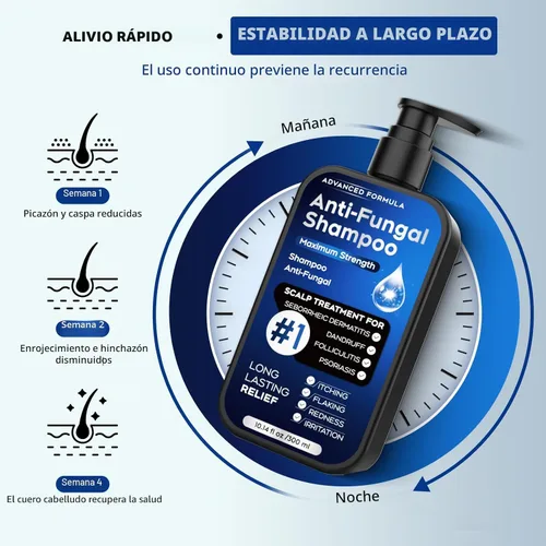 Vista 8 de Champú antifúngico para dermatitis seborreica, foliculitis y psoriasis del cuero cabelludo, champú anticaspa para hombres y mujeres, alivia