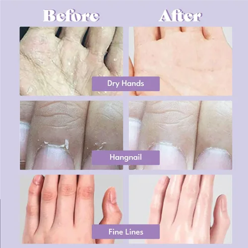 Vista 3 de Máscara de mano extra sedosa, 5 pares, guantes hidratantes coreanos para manos secas con trufa blanca, caviar verde y péptidos, tratamiento