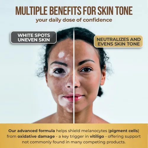 Vista 6 de Dermawonder - Cápsulas de vitiligo (60 unidades) Suplemento eficaz de vitíligo, reduce las manchas blancas y mejora el apoyo de la pigmentación