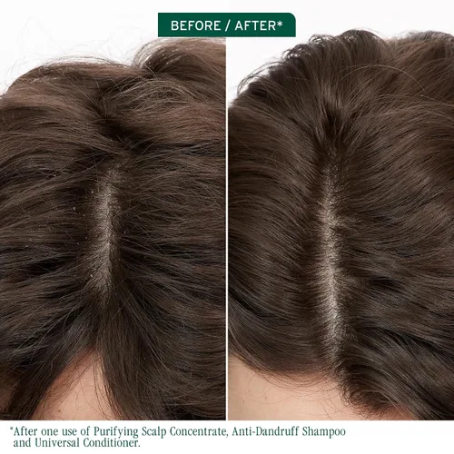 Vista 2 de Biolage Scalp Sync Anti-Dandruff Shampoo & Universal Conditioner Set - Targets Dandruff, Controls The Appearance of Flakes & Relieves Scalp
