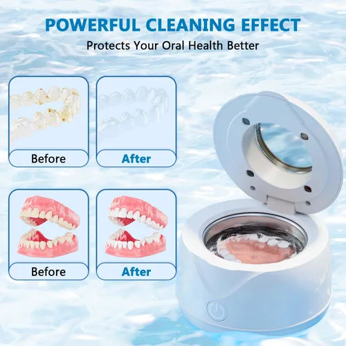 Vista 5 de Máquina limpiadora ultrasónica de retenedores ultrasónicos, 45 kHz, 6.8 fl oz, portátil, ultra sónico, para retenedores dentales, protectores