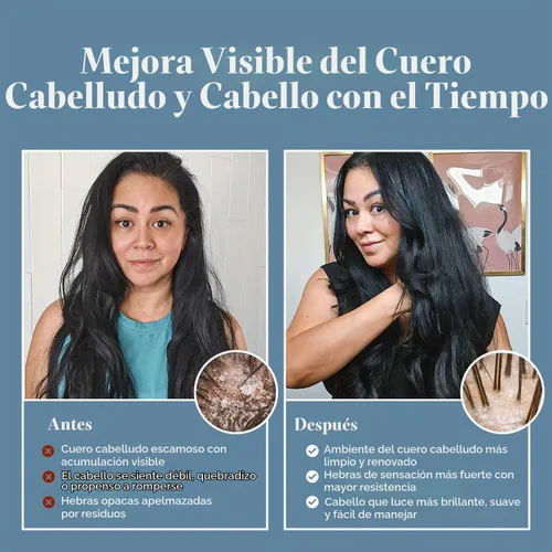 Vista 6 de Champú de ajo para tratamiento capilar. Para cabello normal a seco 32 onzas. Champú Blue Label para cabello seco/quebradizo