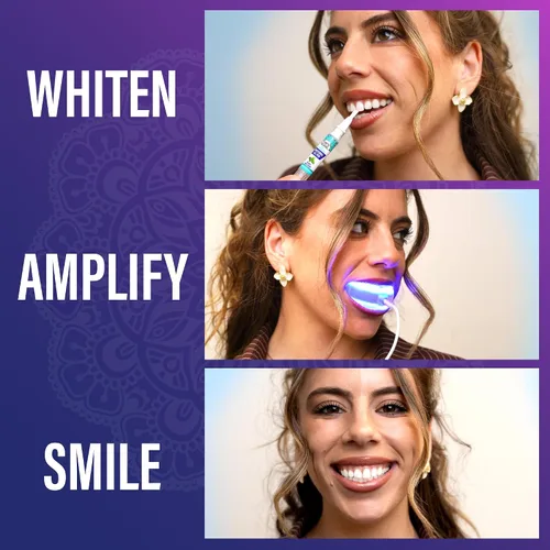 Vista 8 de GuruNanda Kit Premium de Blanqueamiento Dental con Luz LED Conectada y Lápiz Blanqueador, Funciona con iPhone y Android, Ayuda a Eliminar Manchas