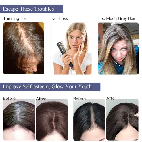 Vista 6 de Toppers de cabello humano con clip, sin costuras, para mujer, base de encaje para cabello picante, 12 pulgadas, rubio decolorado