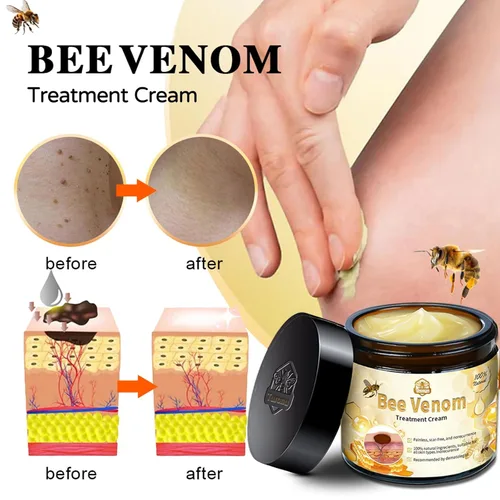 Vista 4 de Turonu - Crema de veneno de abeja, crema de tratamiento de lunares y verrugas de veneno de abeja, crema profesional de tratamiento de la piel