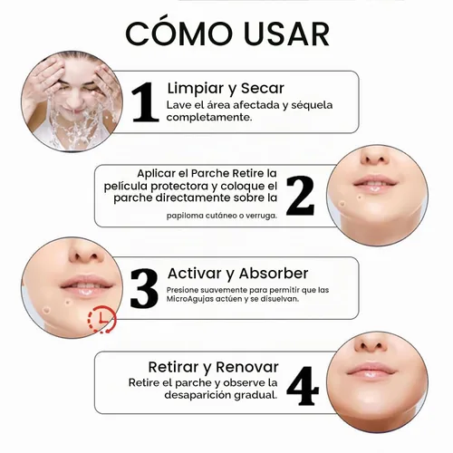 Vista 7 de KUBOZN Pro MicroDardos Patch, hidrocoloide con ácido salicílico, 144 unidades, cubierta invisible contra manchas (1 caja)