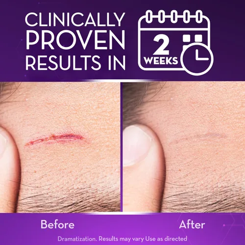 Vista 2 de Cicatricure Gel avanzado para cicatrices faciales y corporales, gel de cicatrices para cicatrices viejas y nuevas, desvanece las estrías, cicatrices