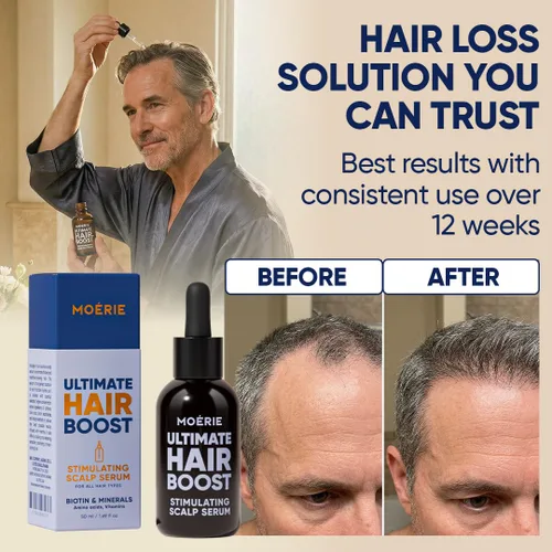 Vista 5 de Moerie Suero para el Crecimiento del Cabello Ultimate para el Crecimiento Natural del Cabello y Engrosamiento - Tratamiento Anti Adelgazamiento