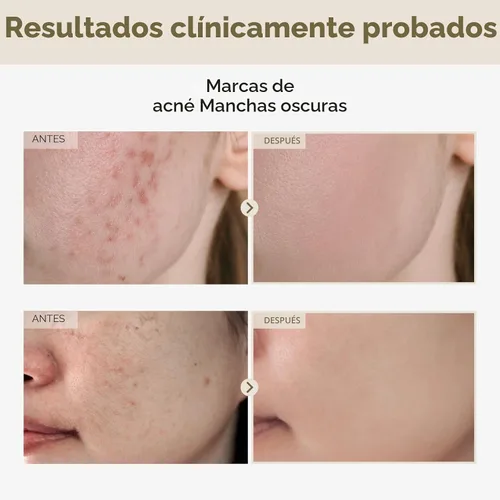 Vista 2 de TOSOWOONG - Suero de arroz 2 %, alfa arbutina, arroz 746,074 ppm, 33 ml/1.11 oz, alfa arbutina 20000 ppm, brillo, glass skin, para pigmentación