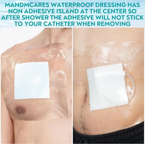 Vista 3 de Hemodiálisis - Cubierta de ducha de catéter impermeable para diálisis peritoneal, protector de vendaje para línea Port Picc acceso al pecho, puertos