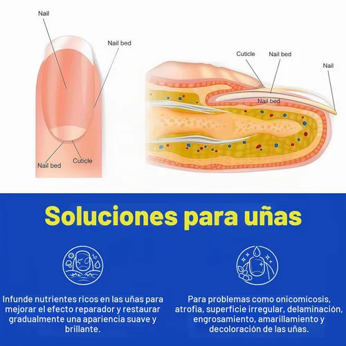 Vista 6 de Parches de uñas fúngicas, 21 unidades, cuidado de uñas durante la noche para uñas débiles y agrietadas, adherencia firme de 8 horas para uñas