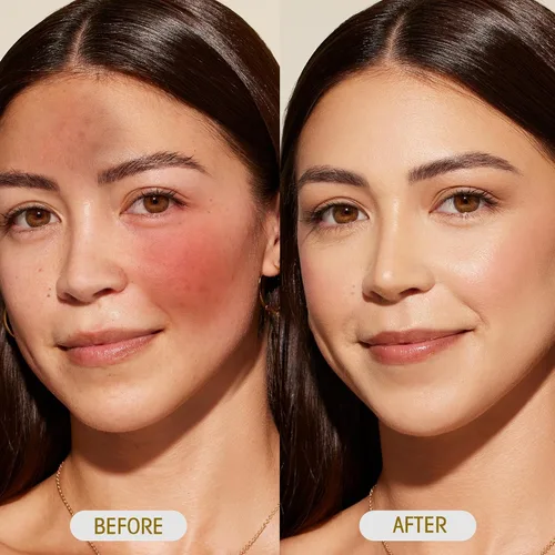 Vista 5 de Aceite facial 100% orgánico de paracres para antienvejecimiento, hidratación, reducción de arrugas y reafirmación de la piel Aceite esencial