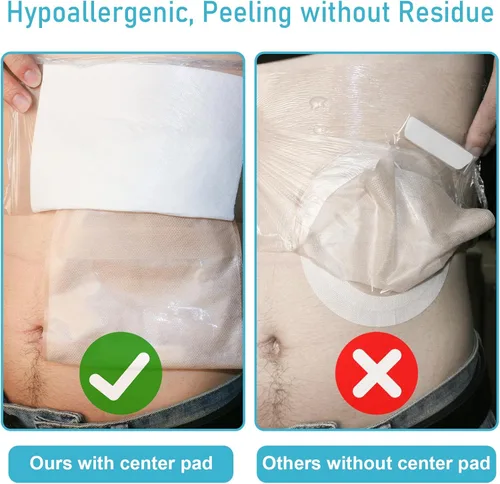 Vista 4 de 25 piezas de bolsa de ostomía impermeable cubierta de ducha de 10 x 10 pulgadas, protector de baño de estoma protector de película adhesiva vendaje