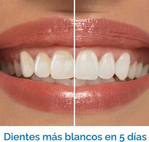 Vista 3 de Pasta de dientes blanqueadora Crest 3D White Advanced Luminous Mint, Pasta de dientes Crest, 3.7 oz Paquete de 4 – Ayuda a eliminar manchas
