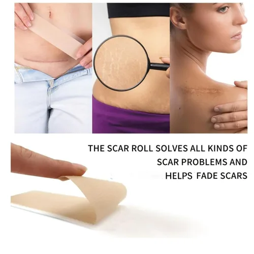 Vista 4 de Losveo - Hojas de silicona para cicatrices para arrugas faciales, tiras de cinta de colágeno de 1.6 x 60 pulgadas para cicatrices faciales, láminas