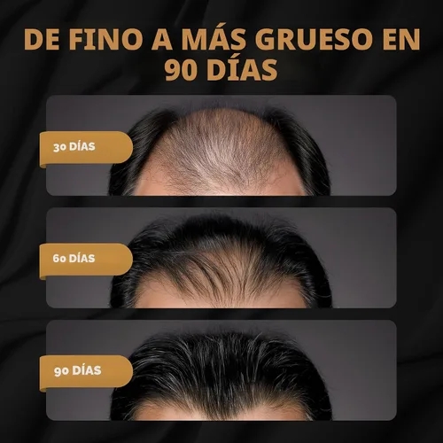 Vista 2 de SPARTAN™ Acondicionador Activador de Raíces para Hombre - Acondicionador para el Crecimiento del Cabello, Hidratante para Cabello Grueso
