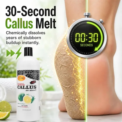 Vista 2 de SPA REDI - Gel removedor de callos para pies - Cuidado profesional de pies de pedicura - Elimina los callos más duros en segundos y suaviza los Lima