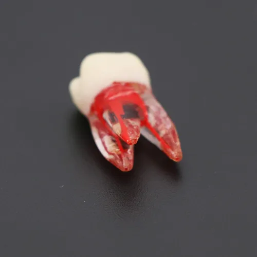 Vista 6 de 10 unids dientes modelo endodoncia archivo práctica pulpa para enseñanza estudio M807 16 #