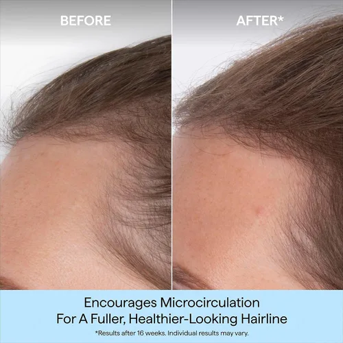 Vista 2 de Briogeo Destinado a la densidad de cafeína + suero de densidad de péptidos de biotina Aumenta el grosor y el volumen del cabello para cabello fino