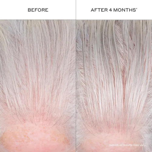 Vista 8 de Zenagen Suero engrosante para el cabello