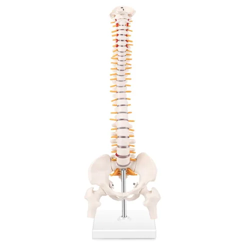 Vista 7 de Modelo de hernia de disco lumbar anatómica humana - Modelo de columna lumbar para enseñar y aprender, modelo de hernia de disco lumbar