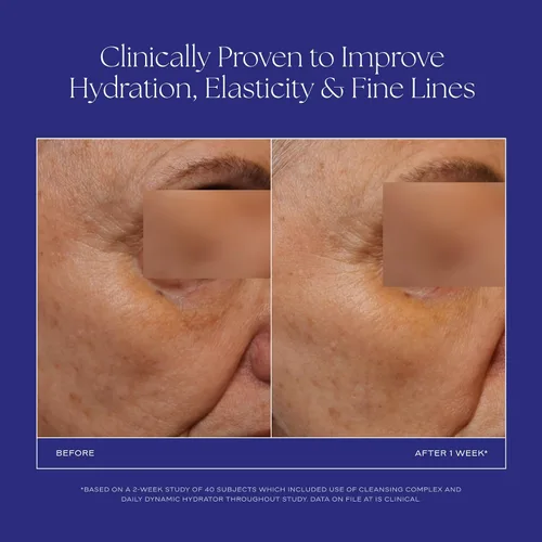 Vista 3 de iS CLINICAL Daily Dynamic Hydrator, hidratante facial antienvejecimiento con ácido hialurónico, repara y protege la piel, alimentado por