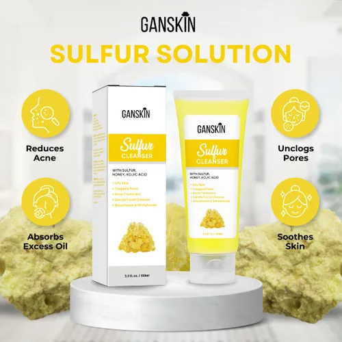 Vista 5 de Jabón de azufre - Gel de baño y cara de azufre - Limpiador facial exfoliante de azufre absorbe el exceso de aceite, reduce el aspecto de brotes