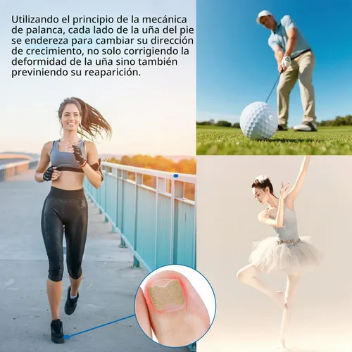 Vista 7 de Kit de eliminación de uñas encarnadas, 50 tiras correctoras de uñas encarnadas sin dolor con levantador de uñas de los pies, lima sin dolor, kit