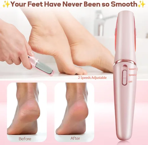 Vista 9 de Removedor de Callos para Pies, ZABOUL Removedor de Callos Eléctrico para Pies Recargable Herramientas de Pedicura Varita de Pedicura Suave Lima